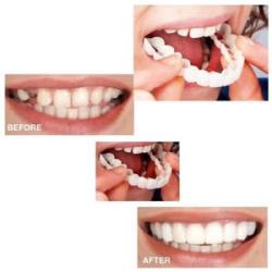 Smiling Snap False Teeth Veneers  Tooth Upper+Lower Teeth