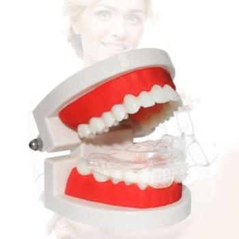 Mouth Guard Tooth Orthodontic Appliance Brace Teeth Retainer Stage 3